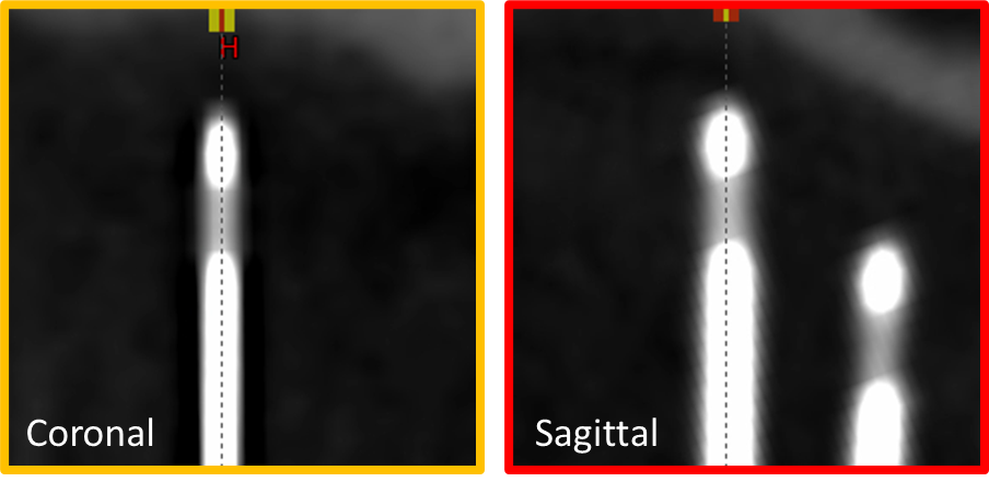 Align Viewing Planes
